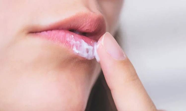 Acyclovir là gì? Cách bôi acyclovir sau phun môi