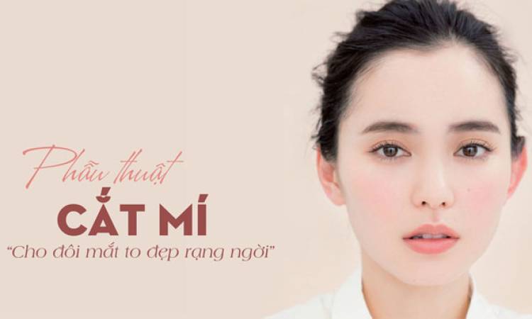 4 Lưu ý quan trọng cần nhớ khi cắt mắt 2 mí Hàn Quốc