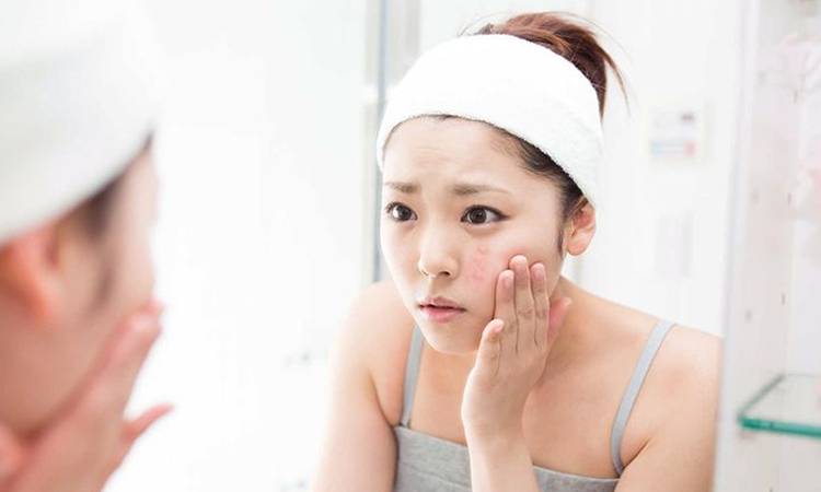 Tại sao có bầu da mặt đẹp hơn?