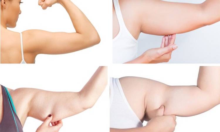 Review hút mỡ bắp tay chân thật nhất - Liệu bạn có dám thực hiện