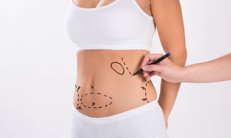 Giải đáp: Hút mỡ có đau không?