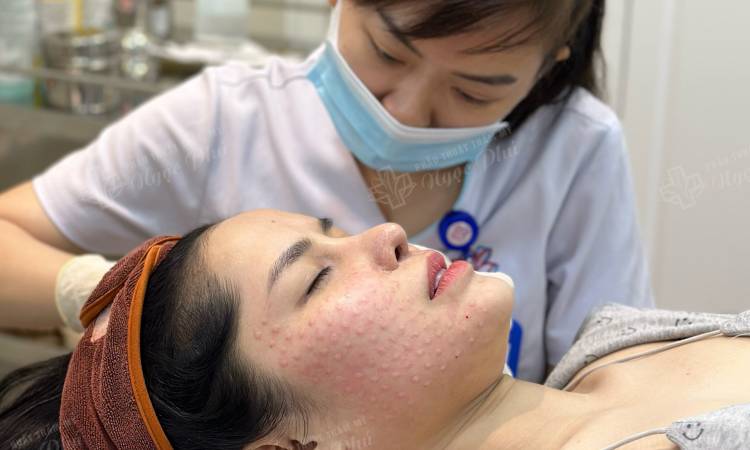Những thông tin cần biết về tiêm Meso