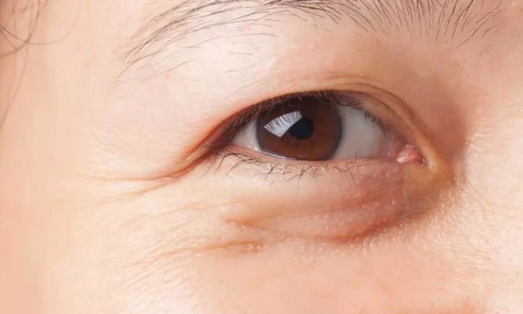 Nâng cung lông mày là gì mà lại được hội chị em yêu thích đến thế?