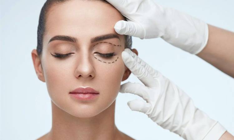 Giải đáp: Nên nâng cũng mày hay cắt mí