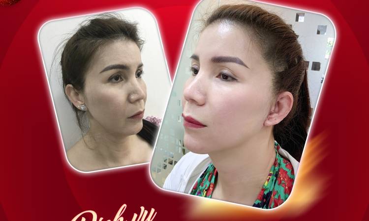 Trả lời vấn đề: 