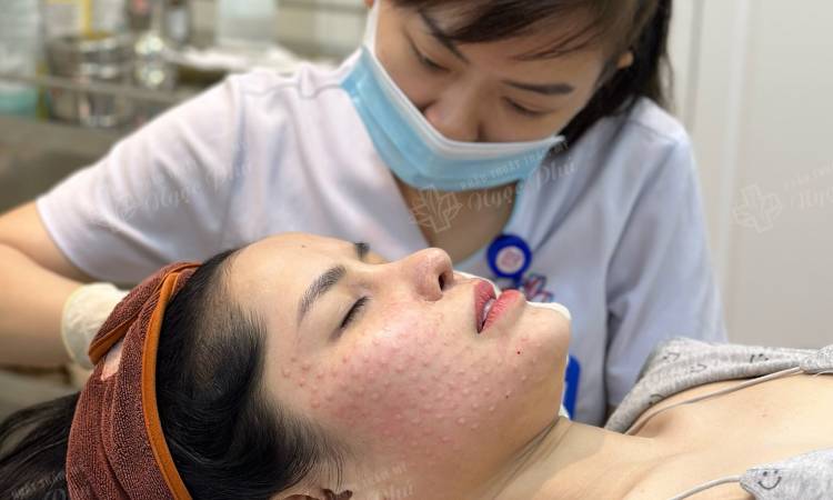 Cách chăm sóc da sau tiêm Meso chuẩn y khoa nhất