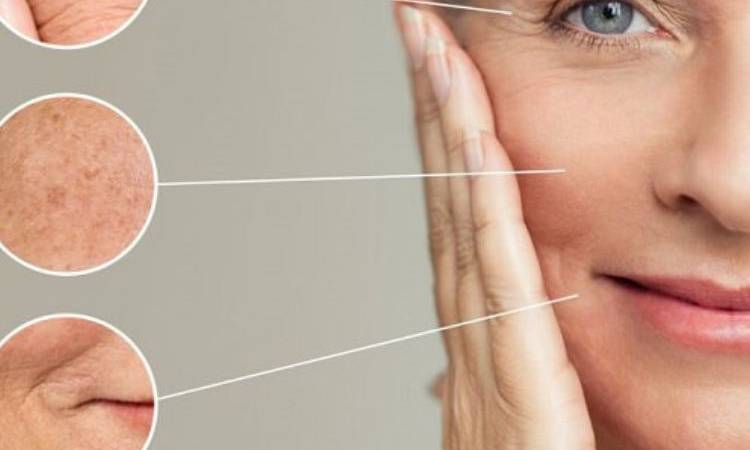 Căng Da Nội Soi Có Trẻ Đẹp Vĩnh Viễn Không?