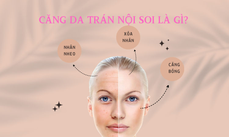 Căng da trán nội soi và những điều cần lưu ý