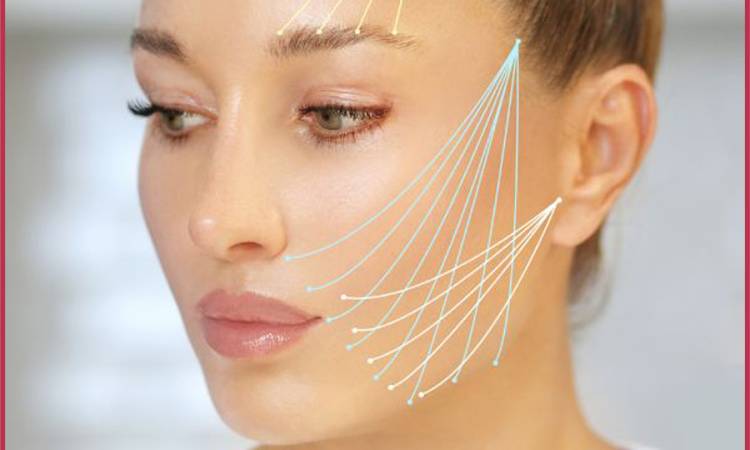 Căng chỉ collagen có mang lại hiệu quả vĩnh viễn không?