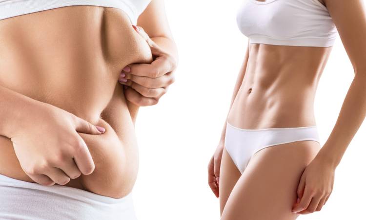 Chăm sóc sau khi hút mỡ bụng như thế nào là hiệu quả