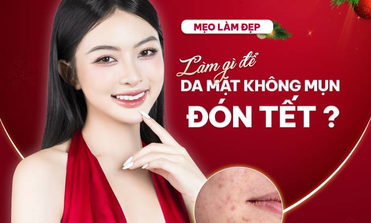 Xông Lá Gì Cho Da Mặt Đẹp Trắng Sáng Hết Mụn