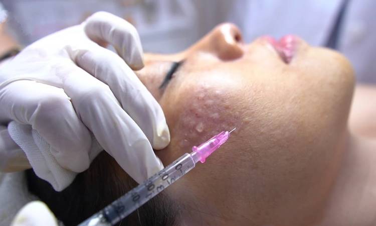Tác hại của tiêm Meso không rõ nguồn gốc