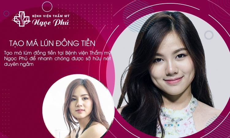 Tạo Má Lúm Đồng Tiền