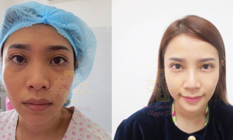 The story of one of our customers: Hoang Dung
