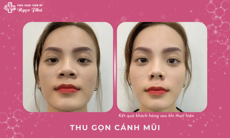 Cuốn Cánh Mũi