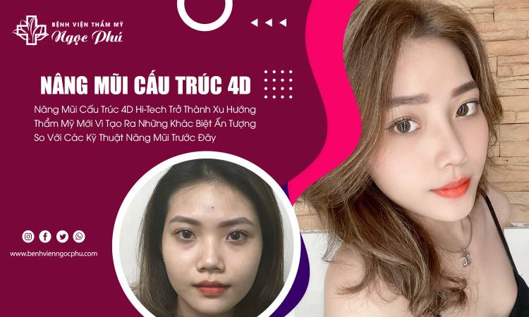 Nâng Mũi Cấu Trúc 4D