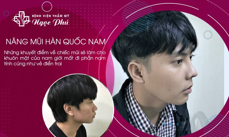 Nâng Mũi Hàn Quốc