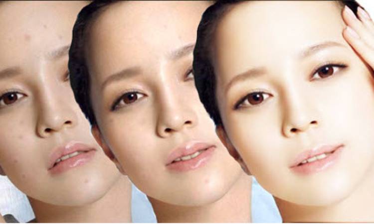 Liệu trình trắng sáng da 3D công nghệ mới