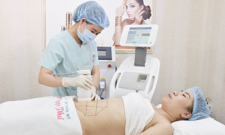 Giảm Béo Không Phẫu Thuật Liposonix