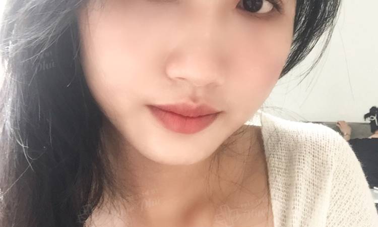 Cắt mắt Hàn Quốc