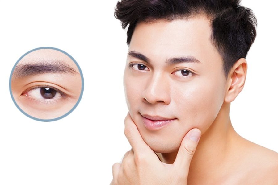 Cắt mắt 2 mí nam giới đang trở thành trào lưu làm đẹp cho phái nam