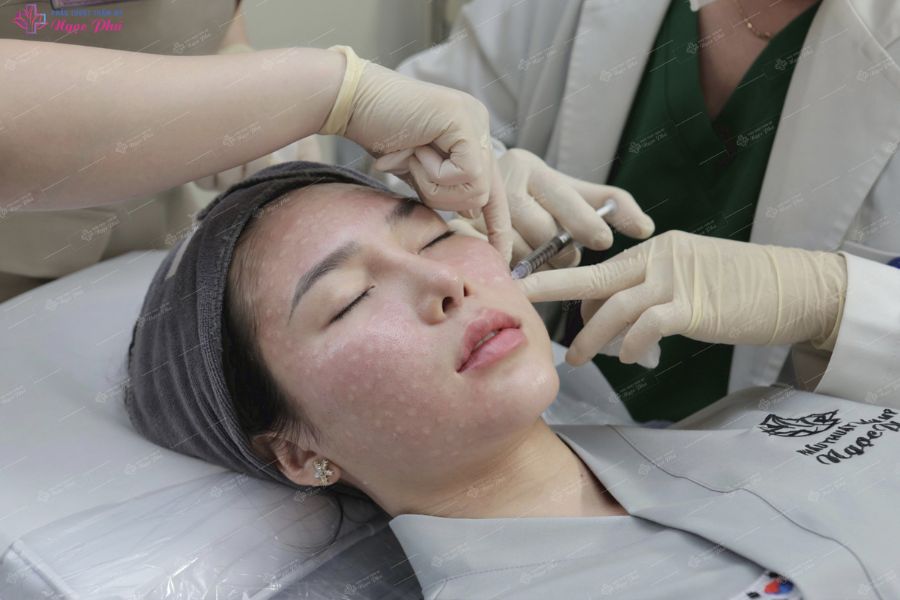Cấy tinh chất Meso để căng bóng da đang trở thành một dịch vụ tiên tiến và phổ biến trong làm đẹp ở Việt Nam và cả trên toàn thế giới. 