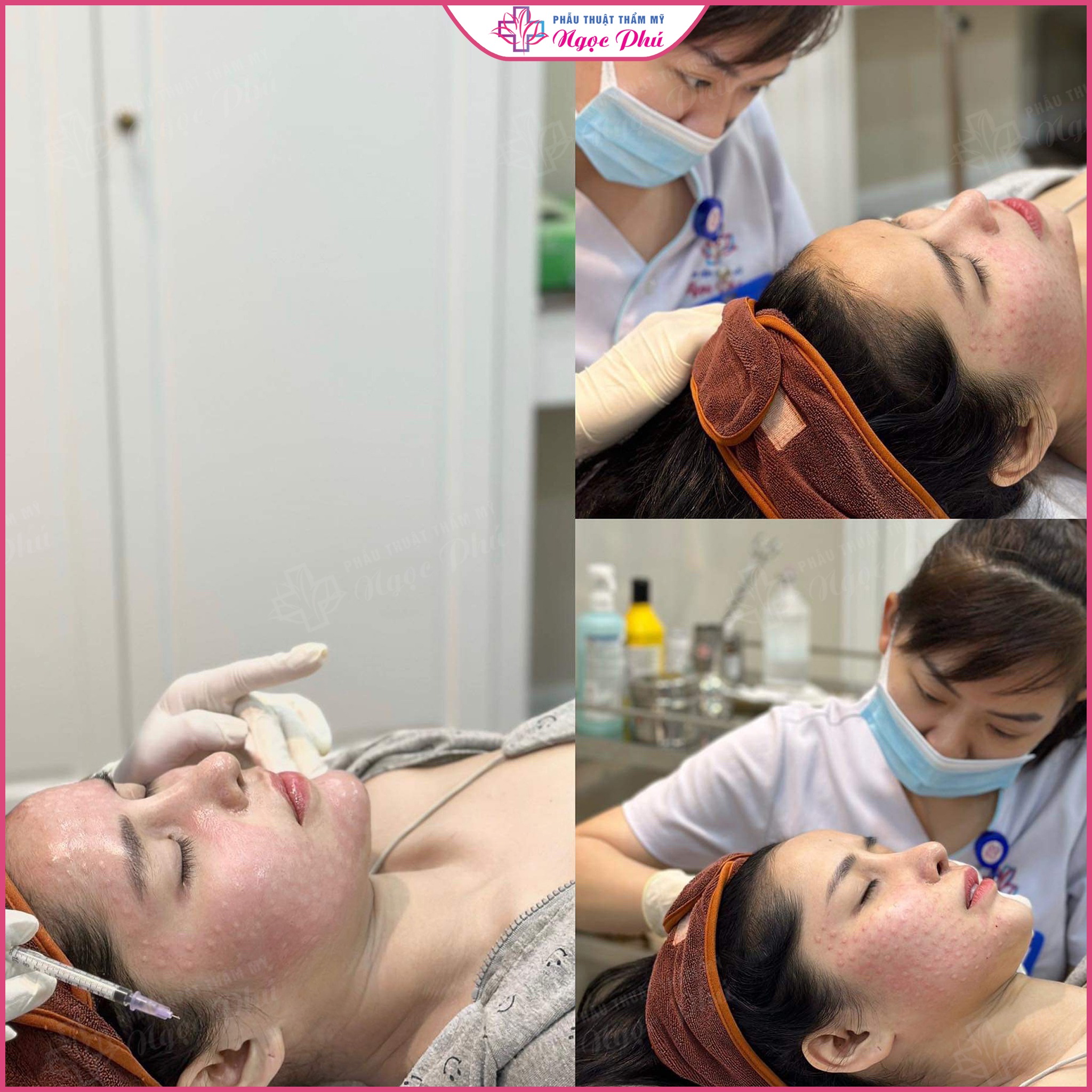 Bảng giá cấy tinh chất Meso tại Ngọc Phú sẽ thay đổi theo từng khoảng thời gian khác nhau