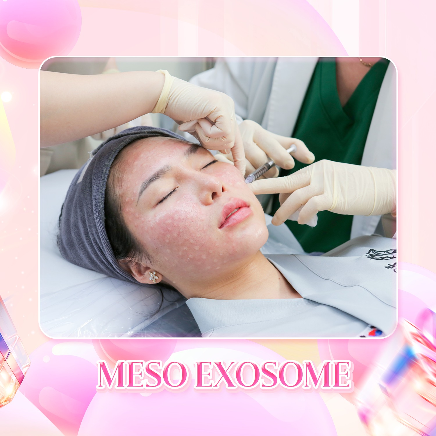 Tiêm meso, hay còn gọi là Mesotherapy, là một phương pháp làm đẹp không phẫu thuật đã có từ hơn 60 năm trước.