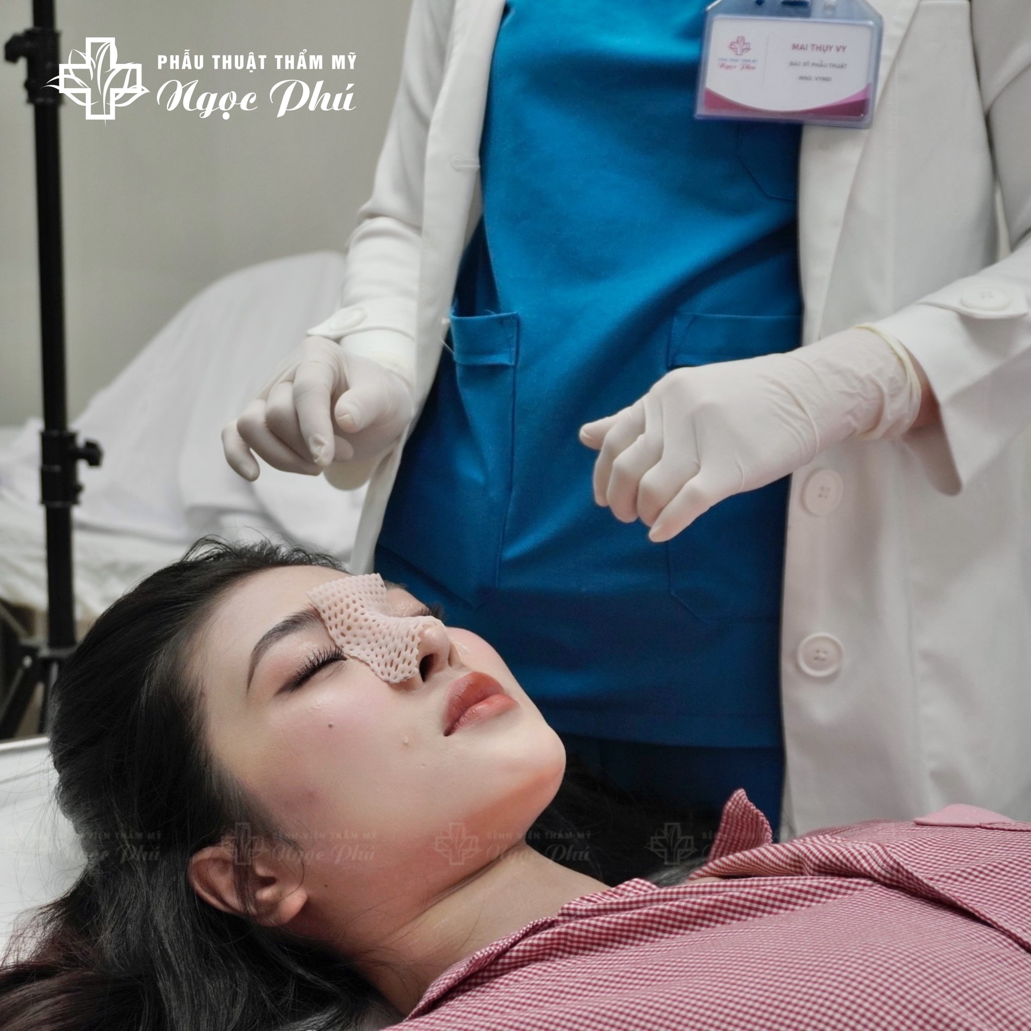 Thông thường, sau khi tháo sụn mũi, mũi bạn sẽ dần dần quay trở lại hình dáng ban đầu. Tuy nhiên, quá trình này có thể mất vài tháng hoặc thậm chí lâu hơn.