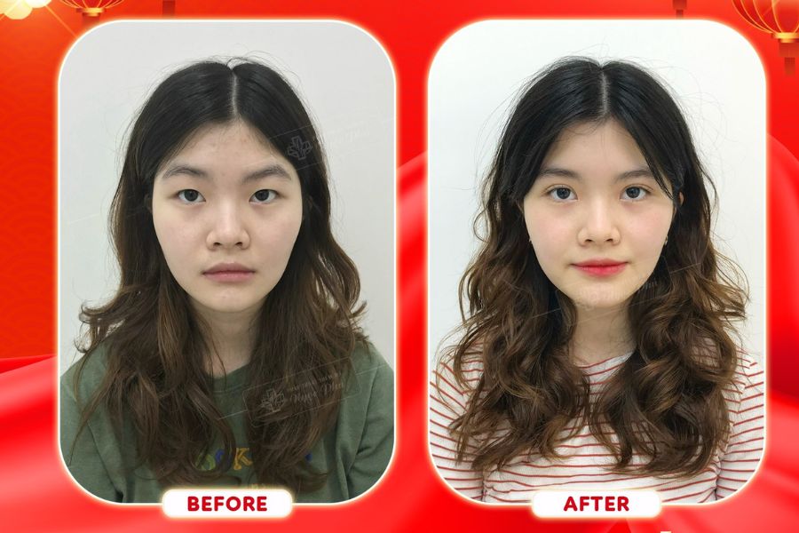 ới những gì bài viết đã review cộng với việc đề cập giá cắt mí mắt ở viện 108 thì đây chắc hẳn là địa chỉ vô cùng tin cậy cho khách hàng. 