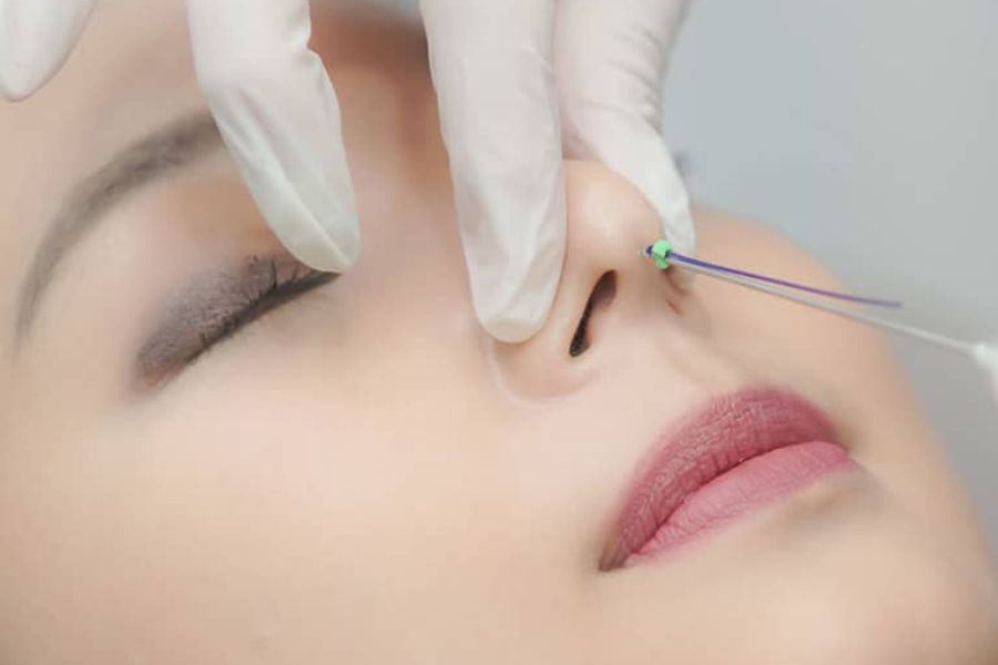 Nâng mũi chỉ có tự tiêu không đó là câu hỏi của nhiều người có ý định áp dụng phương pháp này