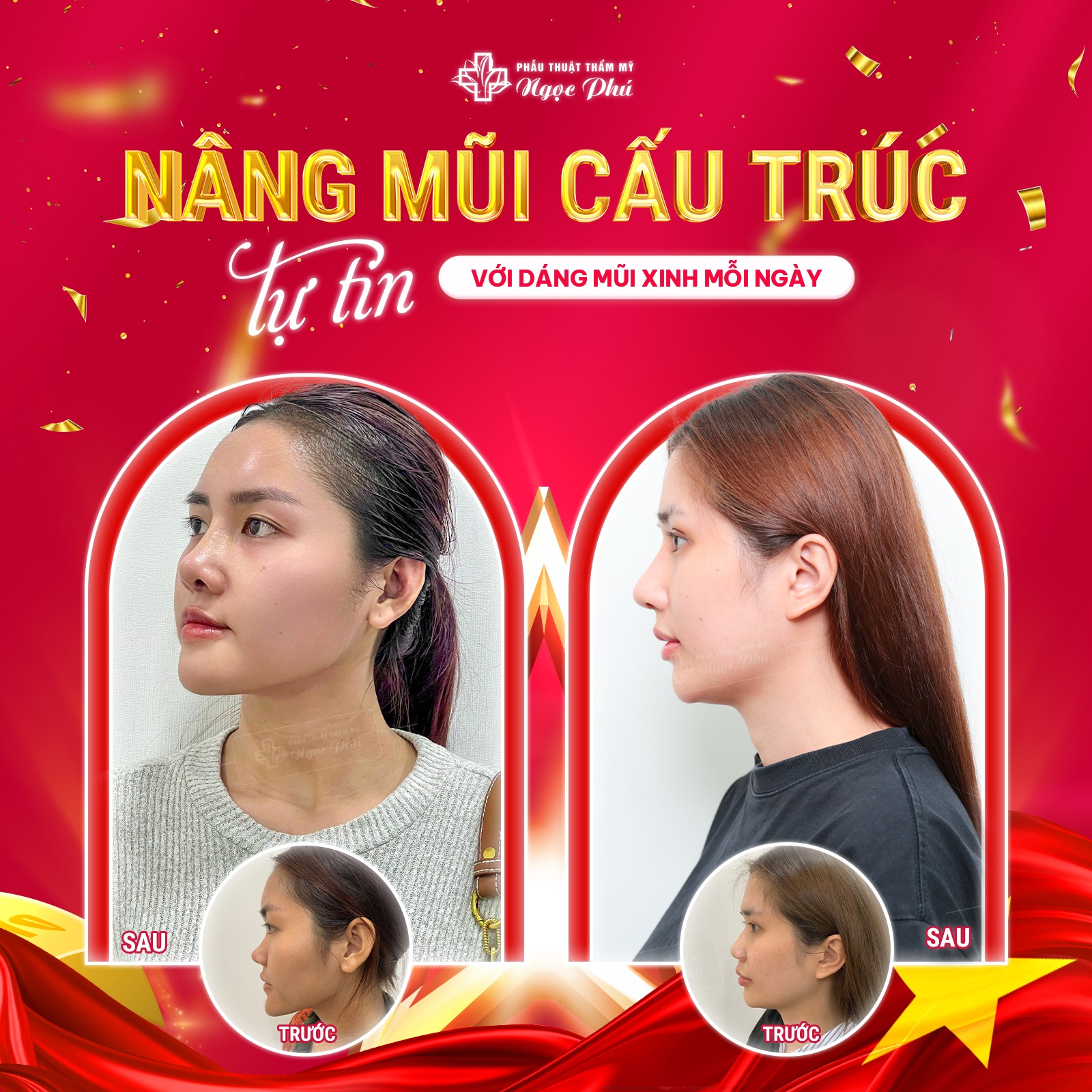 Vậy thì đối với việc sửa, nâng mũi đau không khi thực hiện lại lần 2? Đây là một câu hỏi của nhiều người đặt ra. 
