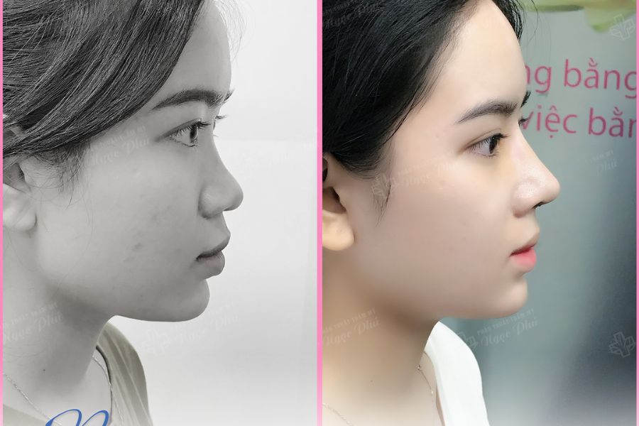 Lựa chọn cơ sở thẩm mỹ có uy tín và đội ngũ chuyên nghiệp là yếu tố then chốt, nói lên kết quả có đẹp và an toàn hay không.
