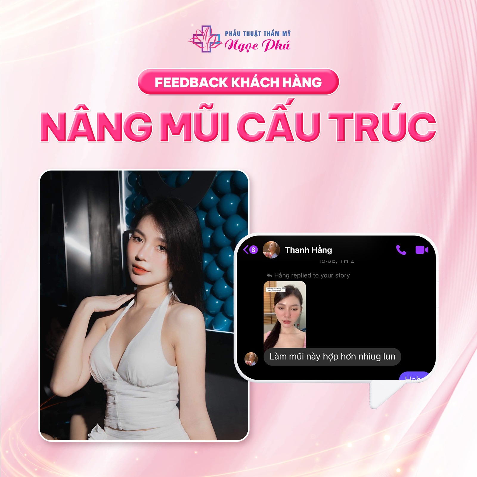 Những ai đang có ý định nâng mũi, mà không biết nâng mũi ở đâu đẹp, review thực tế tại địa điểm TP.HCM.