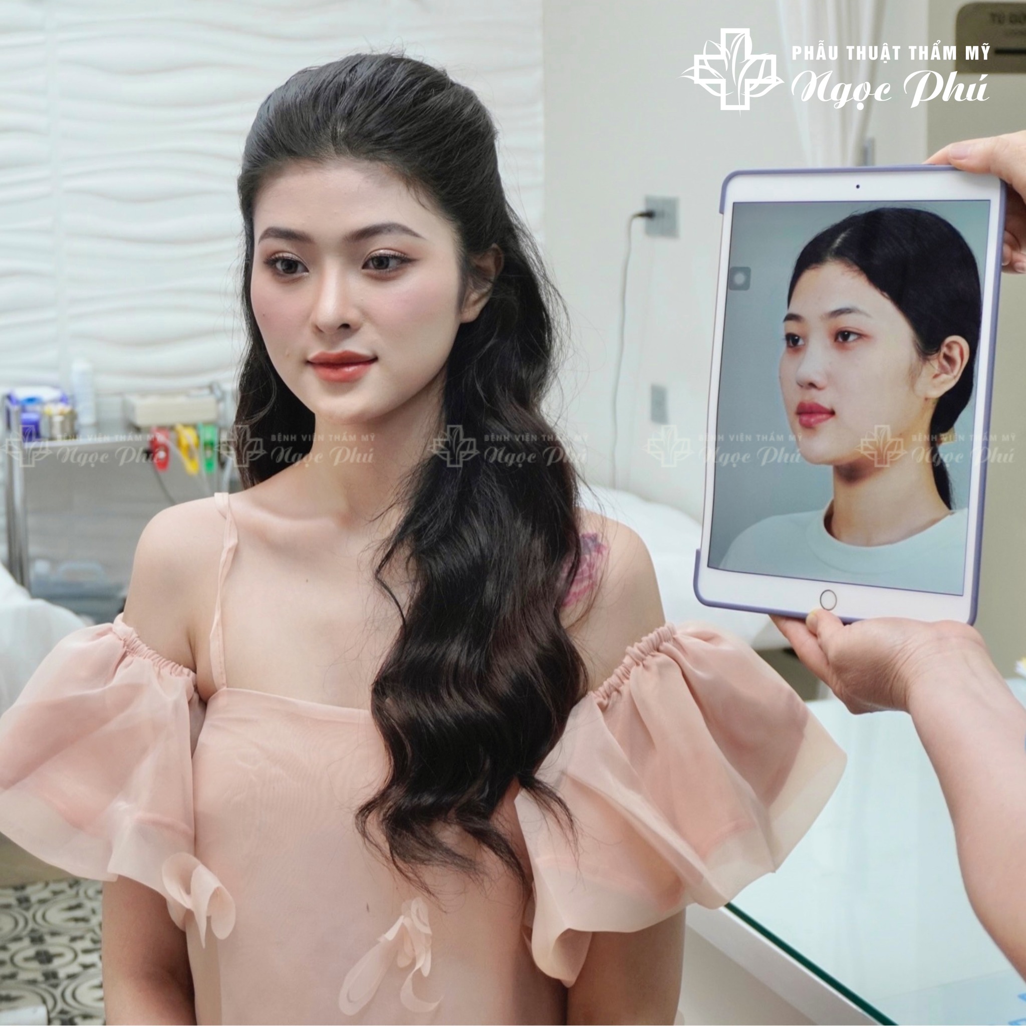 Chị M.N với những lời chia sẻ và mong muốn có dáng mũi đẹp