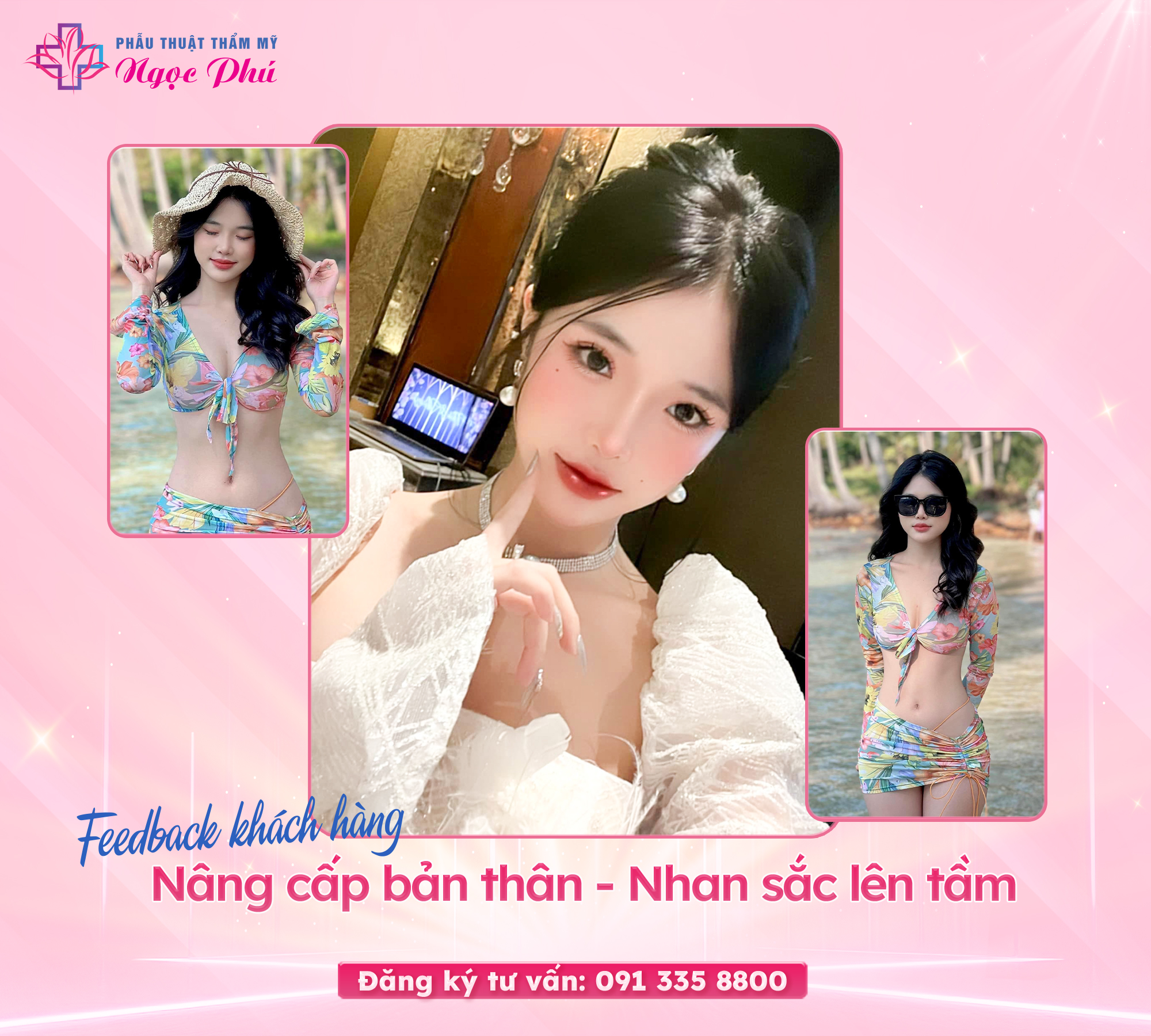 Ai đã từng nâng mũi cũng đều mong dáng mũi của mình sẽ sử dụng được vĩnh viễn, bền lâu nhất, không cần phải đi nâng mũi lại lần 2.