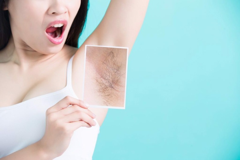 Lông nách là một phần tự nhiên của cơ thể con người, thường xuất hiện ở giai đoạn dậy thì.
