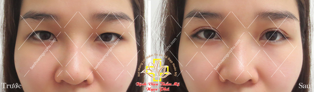 Thẩm mỹ chuẩn Hàn với Giáo sư - Bác Sĩ Lee Jung Hoon-8