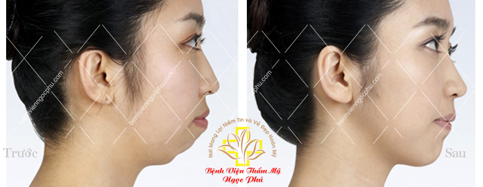Thẩm mỹ chuẩn Hàn với Giáo sư - Bác Sĩ Lee Jung Hoon-6