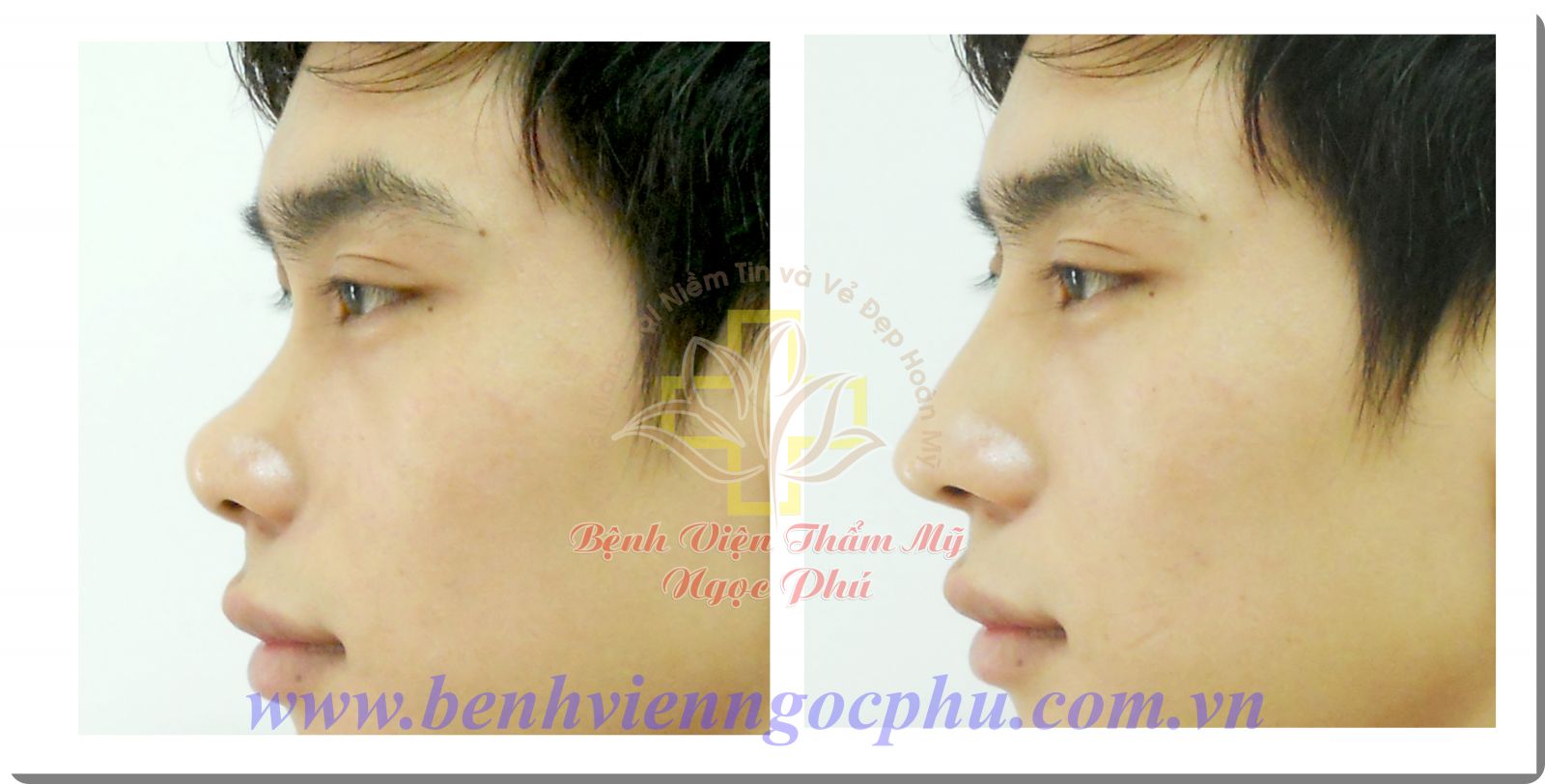 Thẩm mỹ chuẩn Hàn với Giáo sư - Bác Sĩ Lee Jung Hoon-4