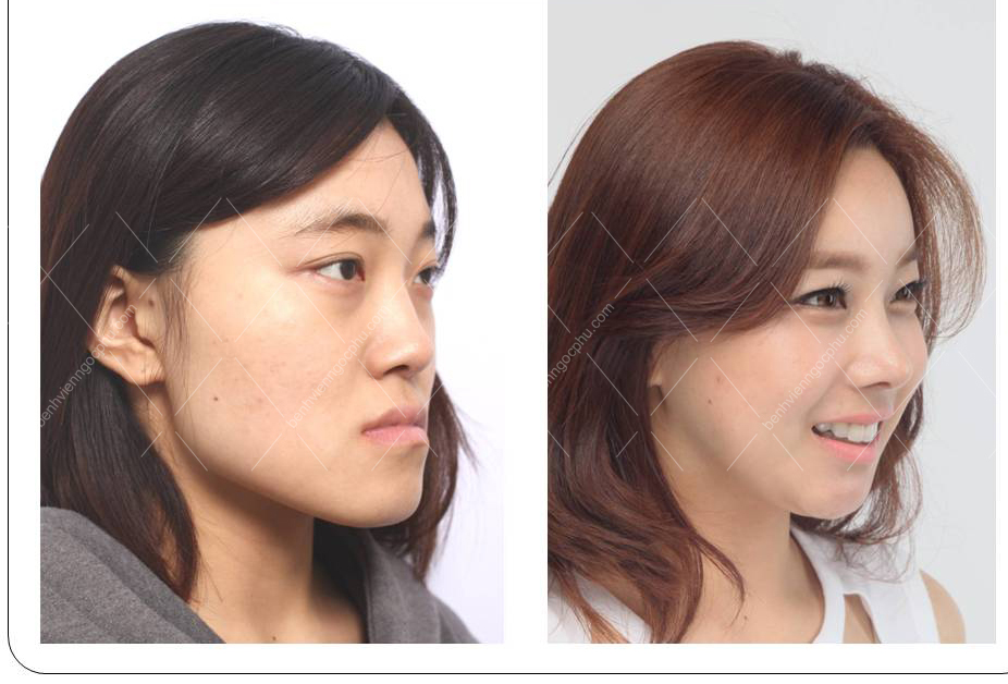 Công nghệ Hàn - Sắc đẹp Việt-6