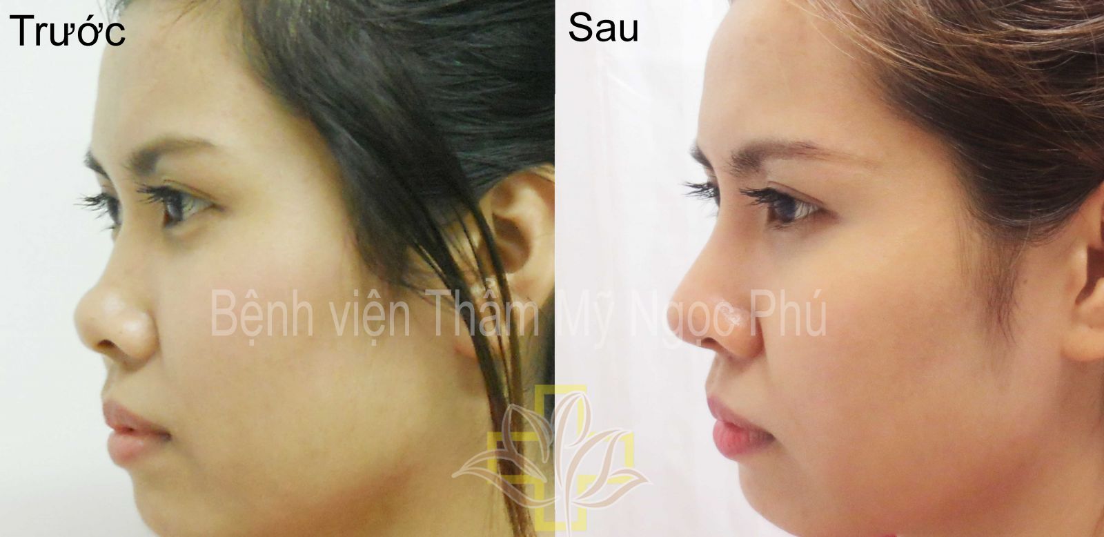 Thẩm mỹ chuẩn Hàn với Giáo sư - Bác Sĩ Lee Jung Hoon-3