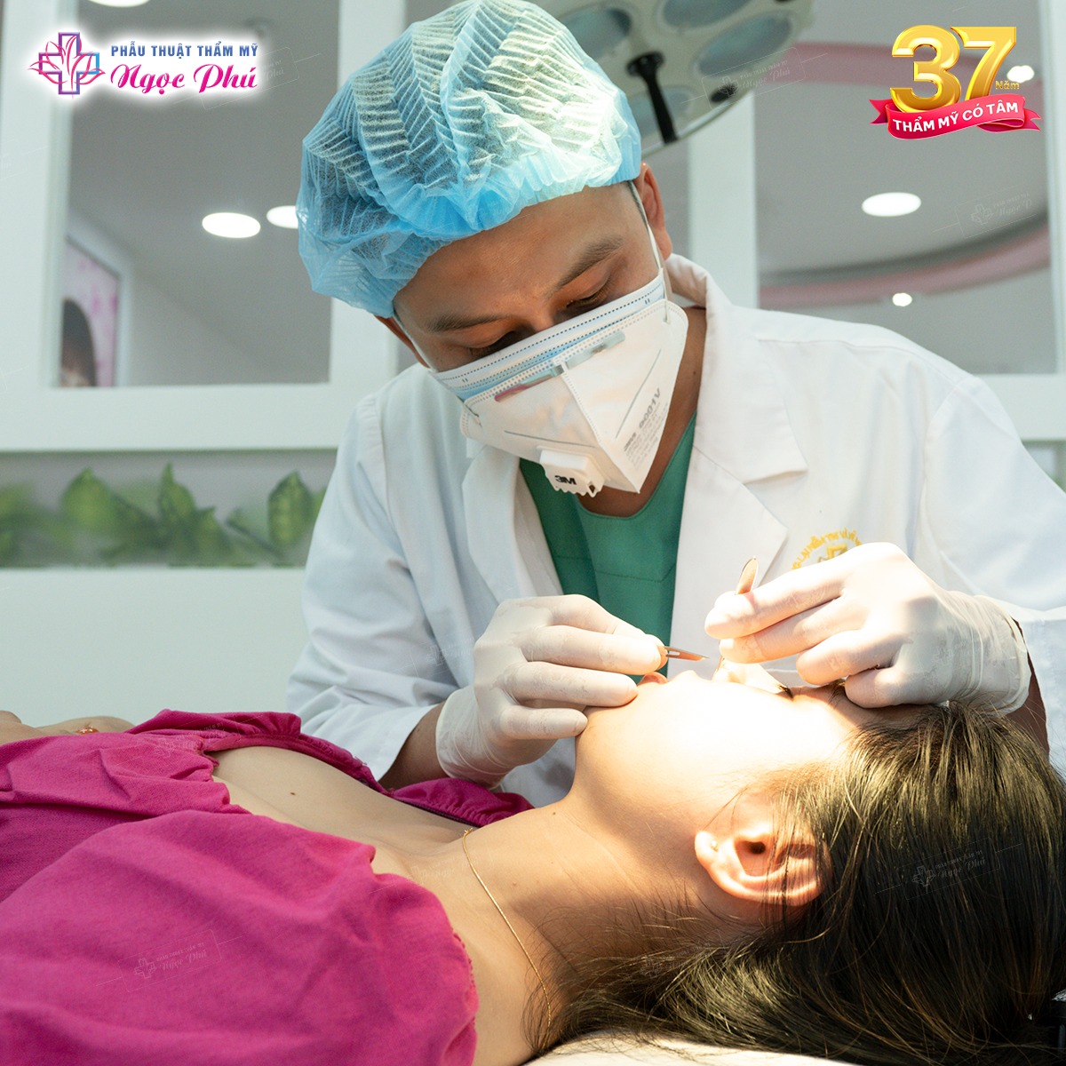 Thời gian hợp lý để cắt chỉ nâng mũi là 8 ngày